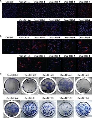 Variability in Susceptibility to Type I Interferon Response and Subgenomic RNA Accumulation Between Clinical Isolates of Dengue and Zika Virus From <mark class="highlighted">Oaxaca</mark> Mexico Correlate With Replication Efficiency in Human Cells and Disease Severity